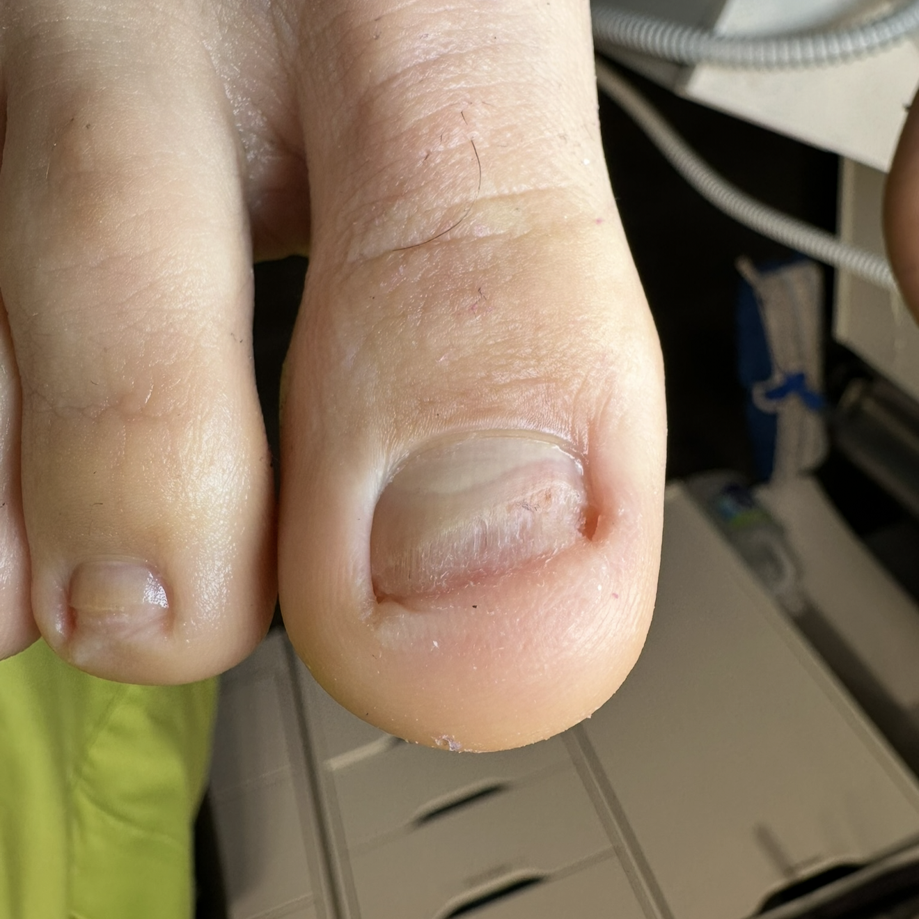 Advanced Perfect Nail Shape Follow