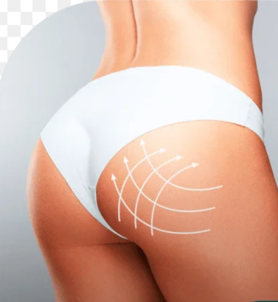 Gluteos Up