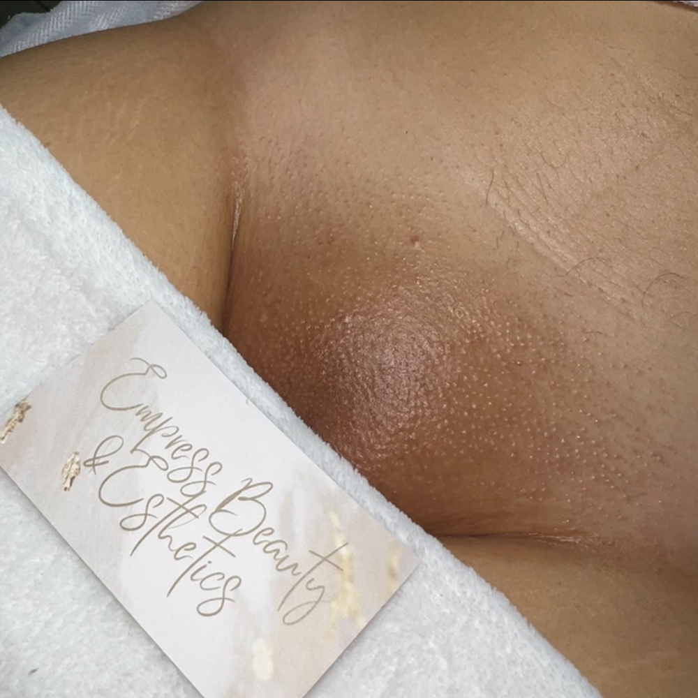 Brazilian Wax
