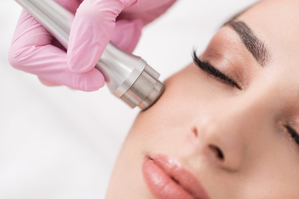Microderm Facial at Joslin Studio in Great Bend, KS