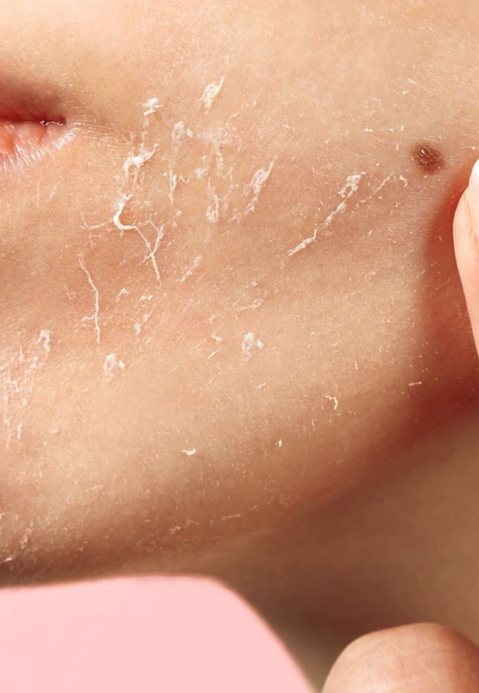 Signature Chemical Peel