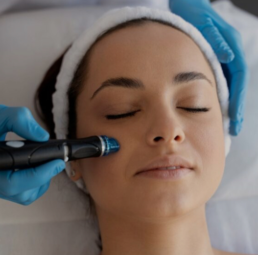 Hydro Dermabrasion Facial at Sister Skincare by Gracie in Placentia, CA