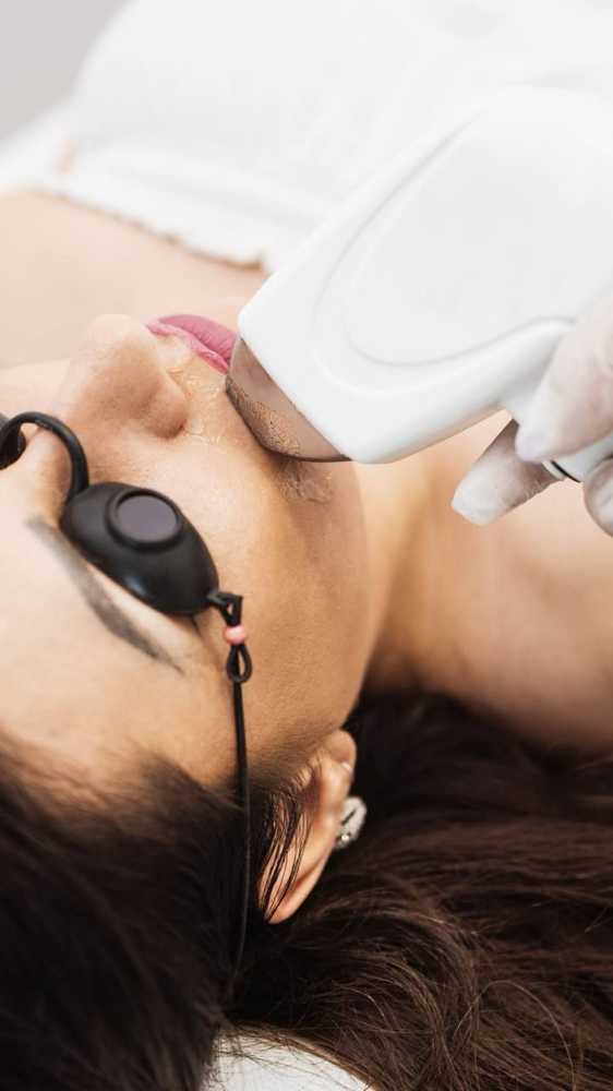 Upper lip / Bozo at LUXOR BEAUTY BAR in ALPHARETTA, GA