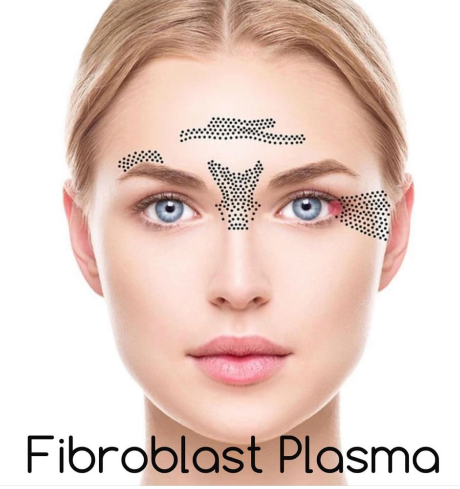 Fibroblast Full Face Lift at Faces by DeAngela in New Brockton, AL