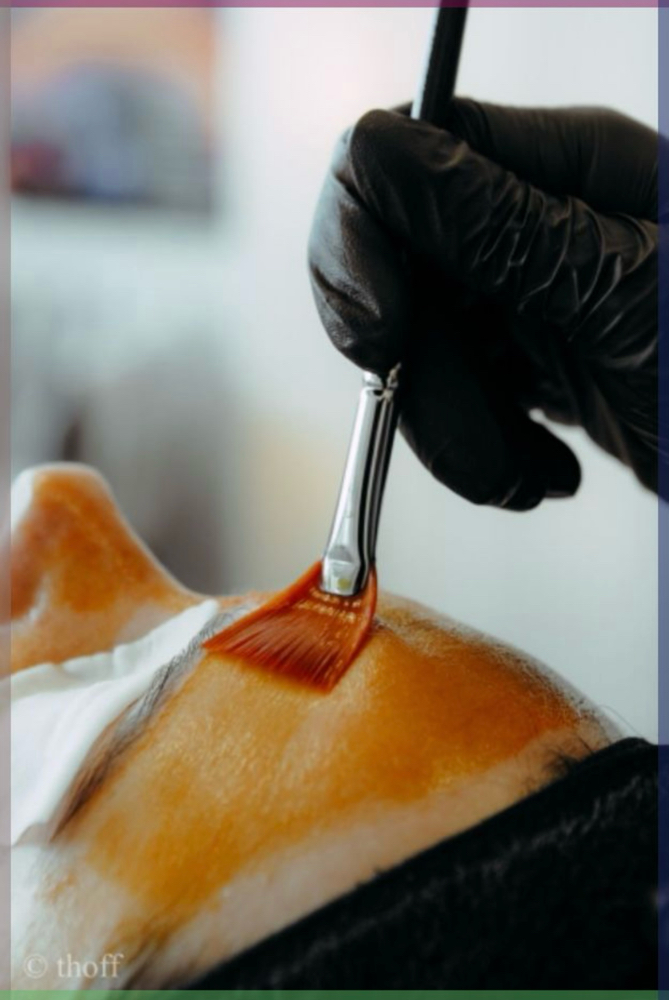 Lira Smart Peel Facial
