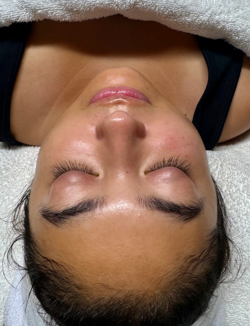 “The Ultimate Skin Glow”