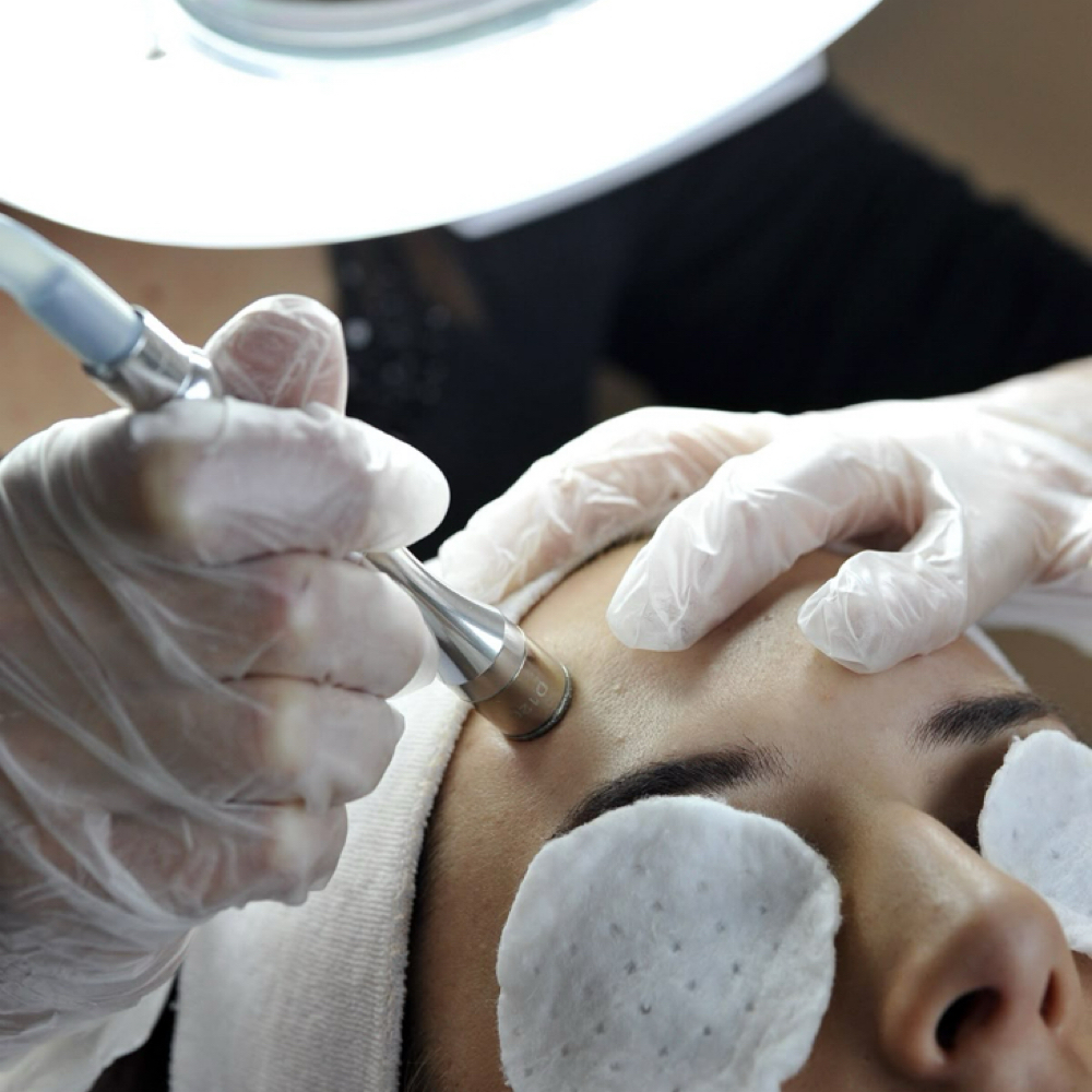 Microdermabrasion Tightening Facial at Sage Esthetics in Pembroke, MA
