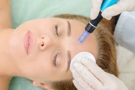 Nano infusion add on