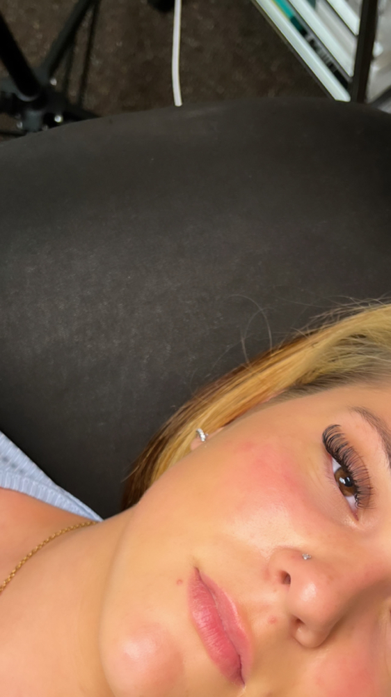 Hybrid Fill