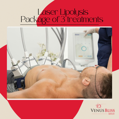 Laser Lypolysis