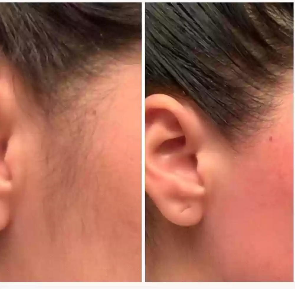 Sideburn Threading Or Wax