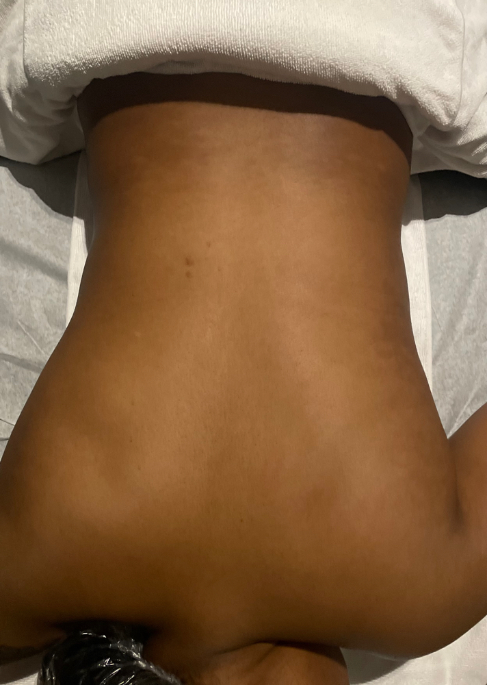 Back Facial