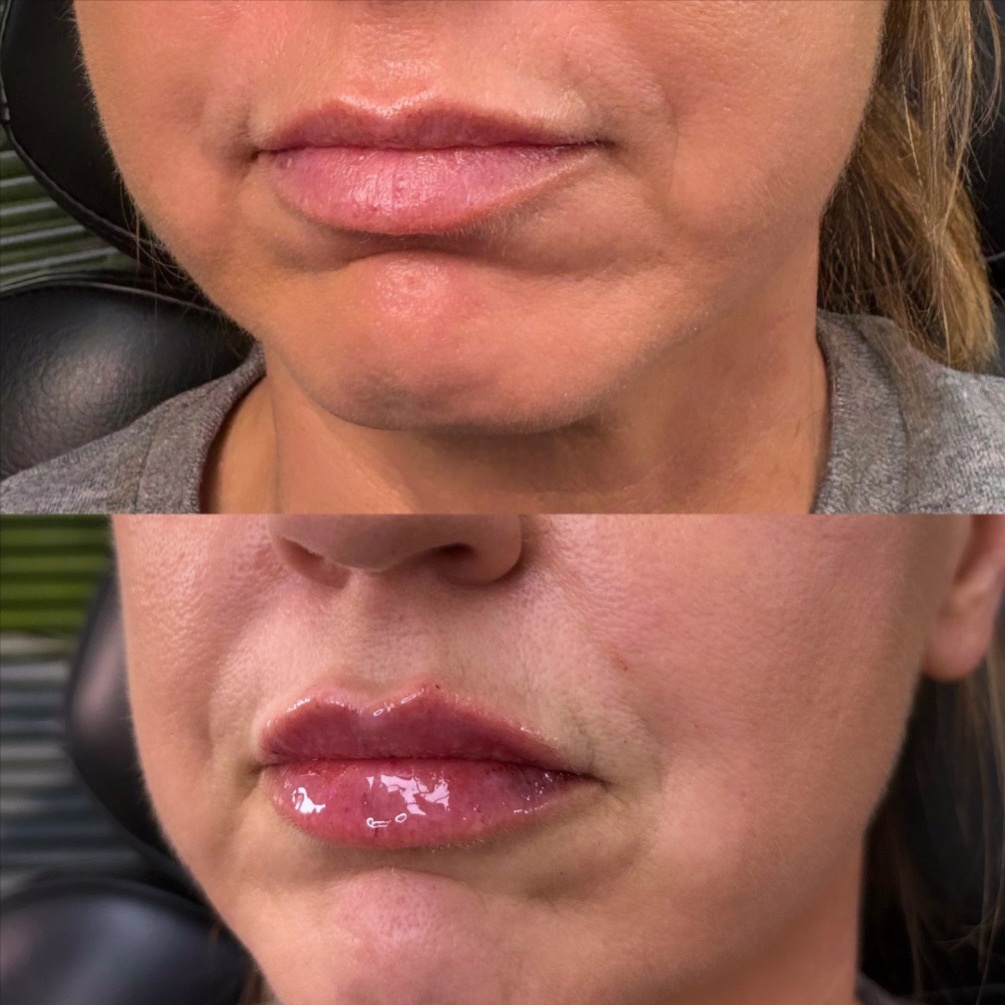 Lip Hydration at Plush Lash + Era Aesthetics in Alexandria, VA