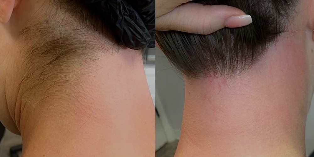 Neck