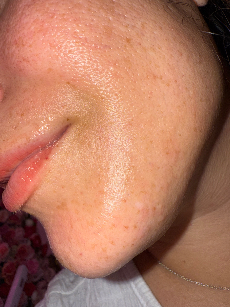 Glow2 Oxygen Facial Treatment