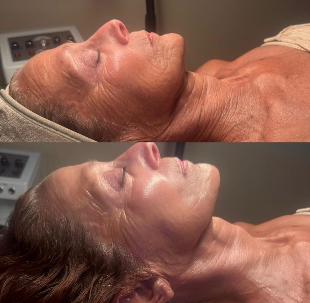 The LuxeLift Facial