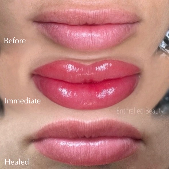 1 - 2 Year’s Lip Touch Up