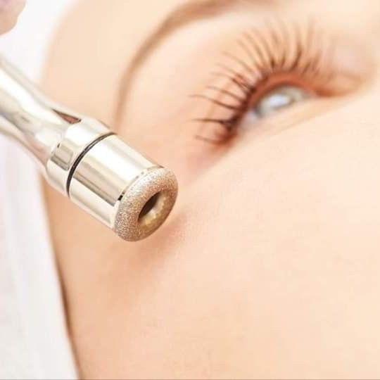 Diamond Glow Microdermabrasion at AGELESS SKIN BY ASEEL MED SPA in Prosper, TX