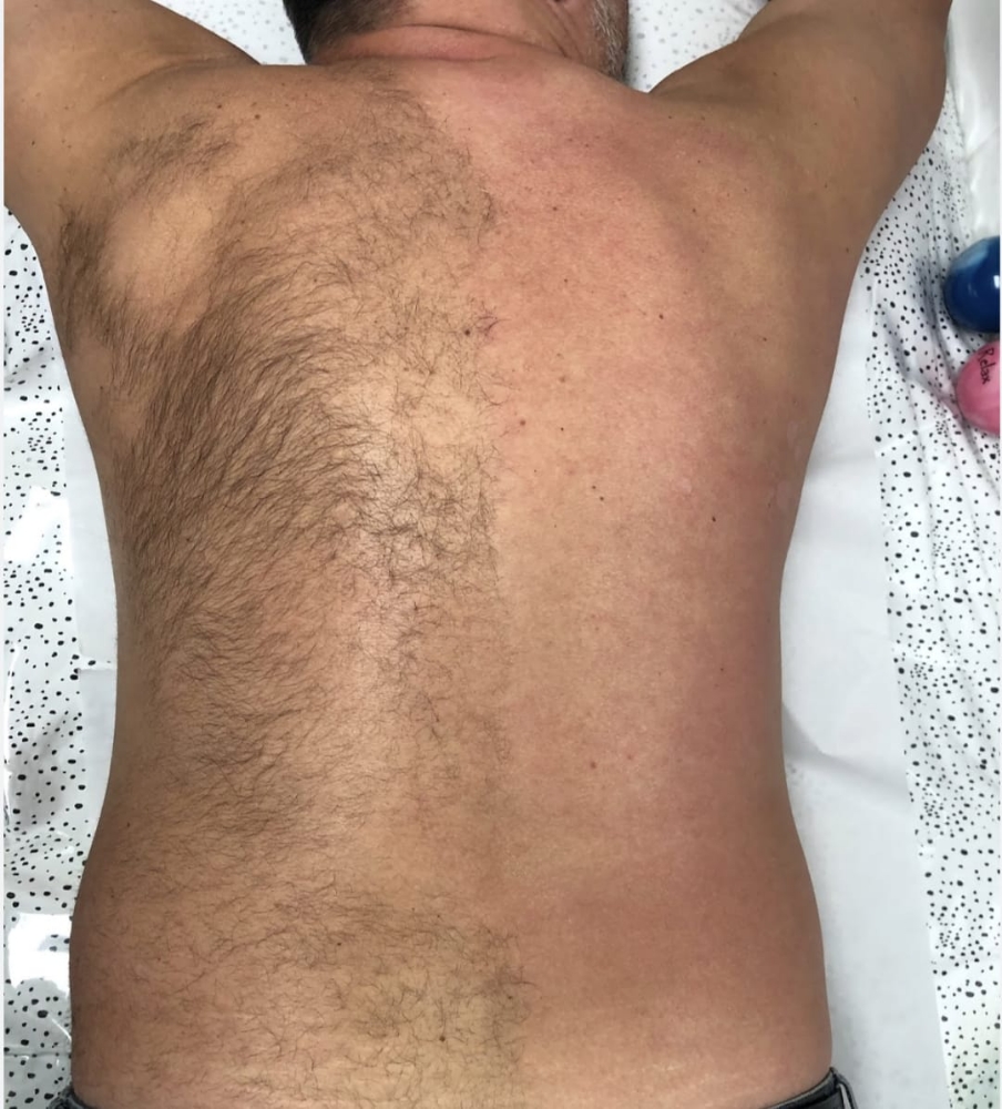 Full Back Or Chest Waxing