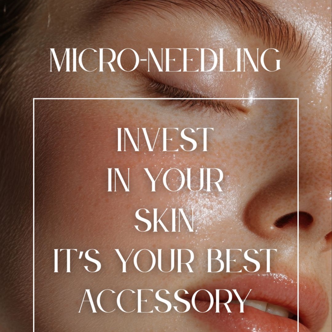 Micro-needling at Shannon Christine Skin in Sparks, NV