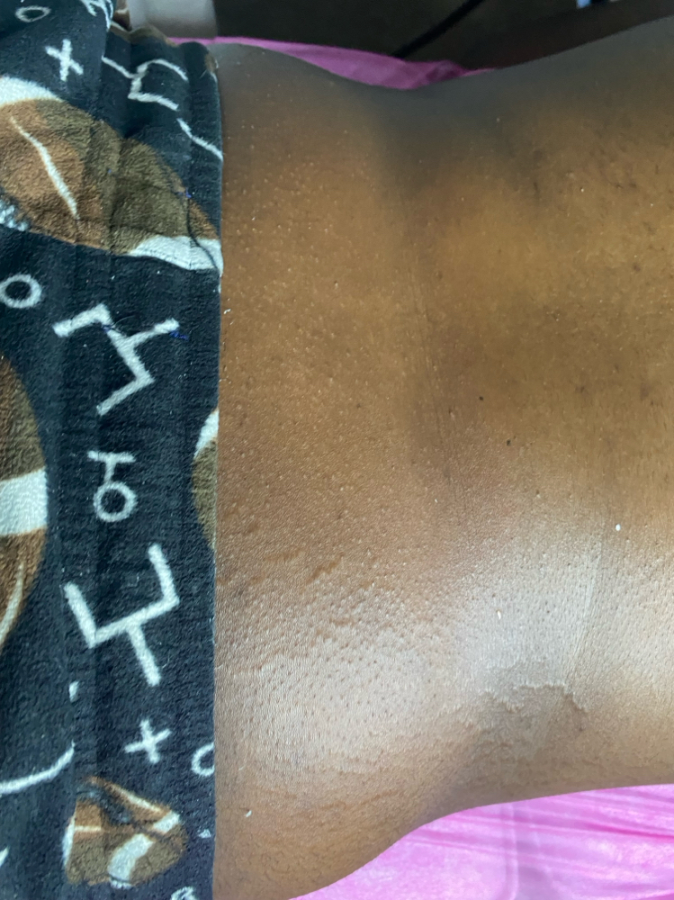 Back Wax Full at Eximius Bella in Garner, NC