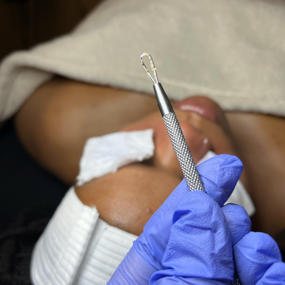 Extractions at Beauty Blvd in Columbus, OH