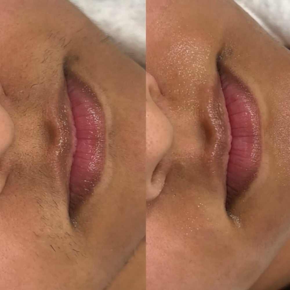 Lip Wax at You Glow Girl Esthetics in Roscoe, IL