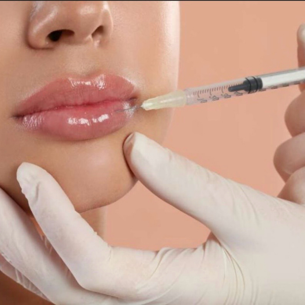 Lip Filler at WYO LifeStim Wellness Spa & Nail Bar in Laramie, WY