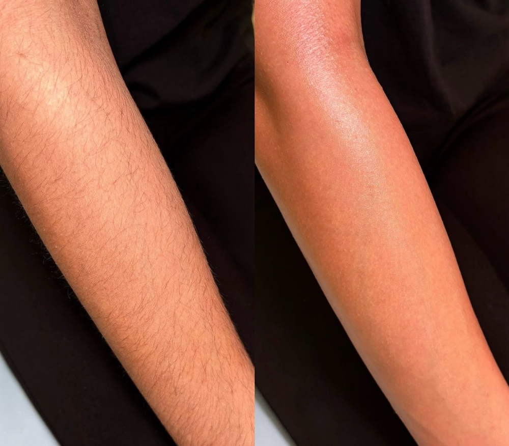 Full Arm Wax