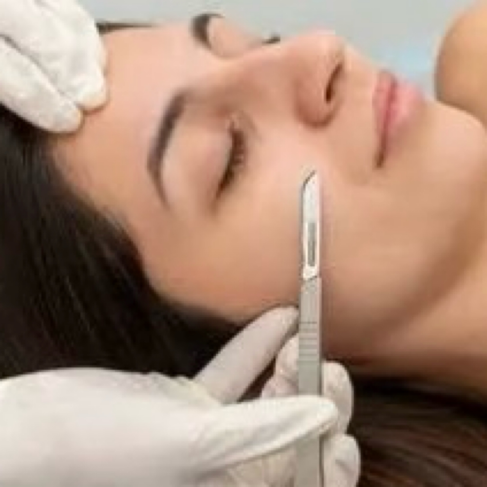 Dermaplaning at Eagle Eye Beauty LLC in Worcester, MA