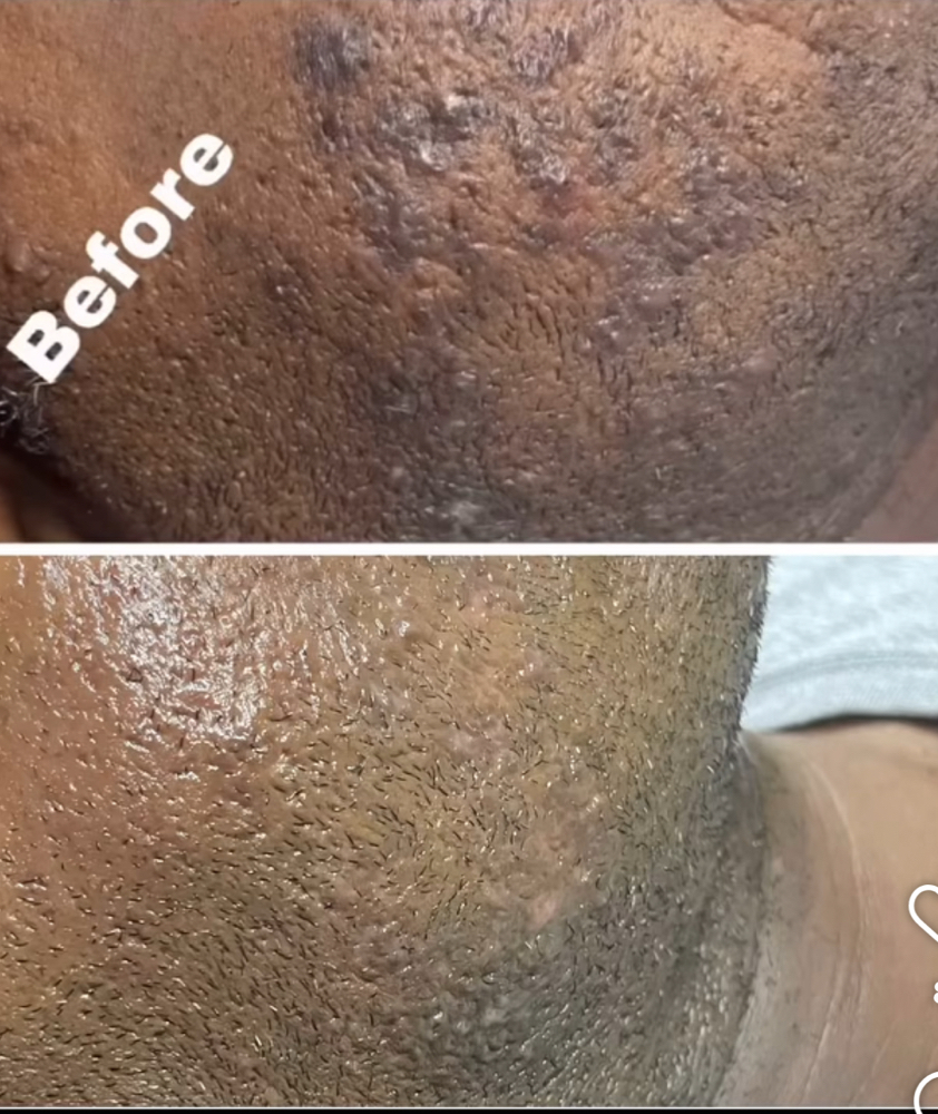 Glow Up Skincare Program