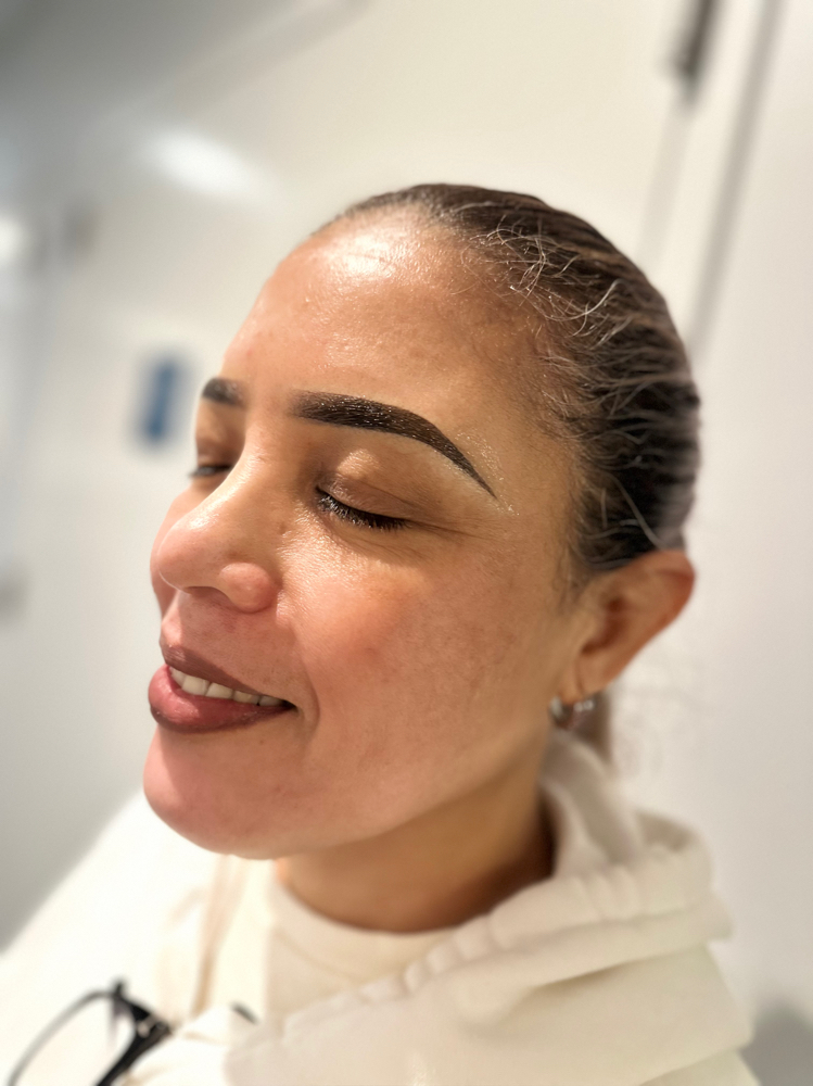 BROW CORRECTION/COVER UP PROCEDURE