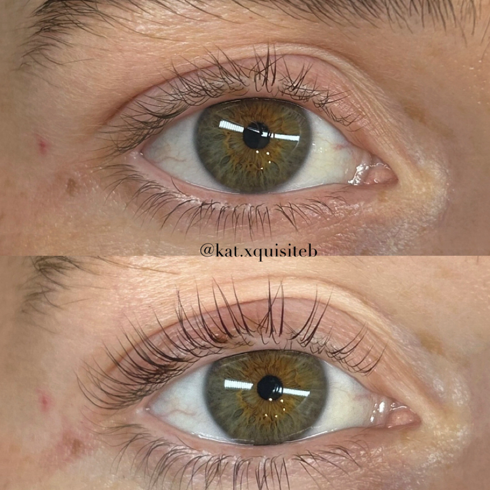 Korean Luxe Lift at Exquisite Studios in Lady Lake, FL