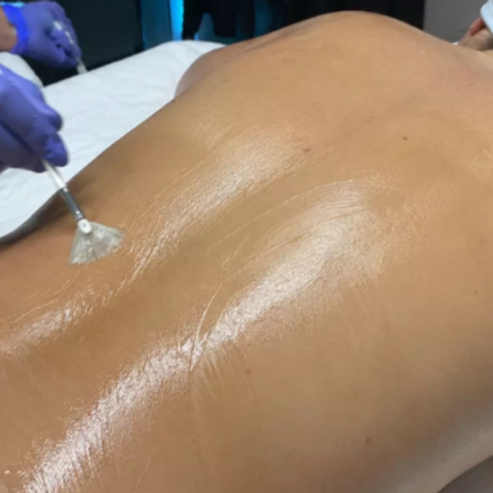 Korean Back PEEL ADD ON at Mend Esthetics Skin & HeadSpa in Ellicott City, MD