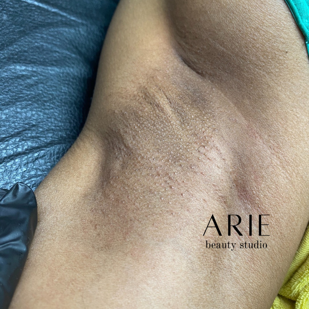 Underarm Wax