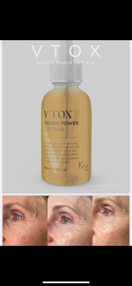 Vtox Add On
