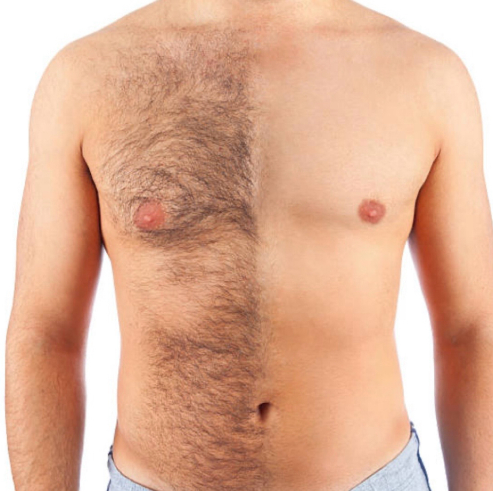 Chest Wax