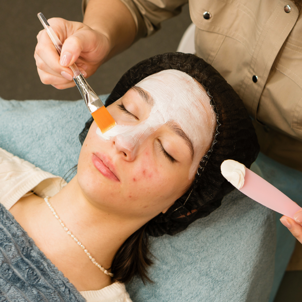Acne Targeting Facial