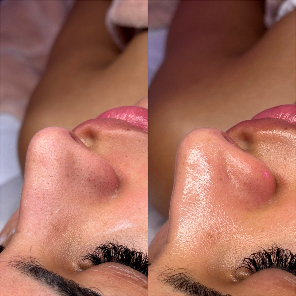 Glow Up Facial