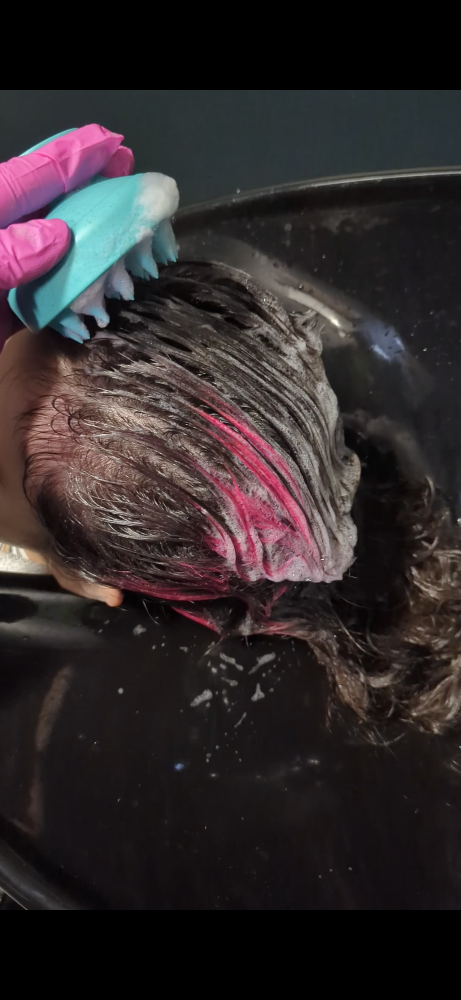 Scalp Treatment