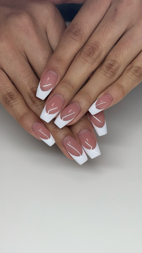 Hardgel overlay
