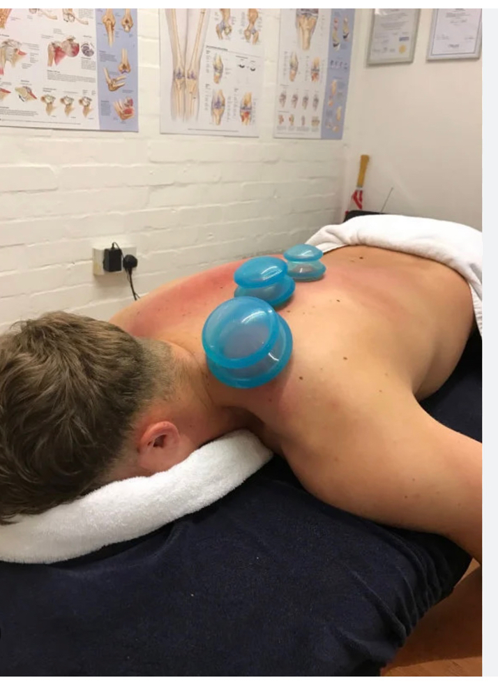 Add On Cupping To Massage Appt