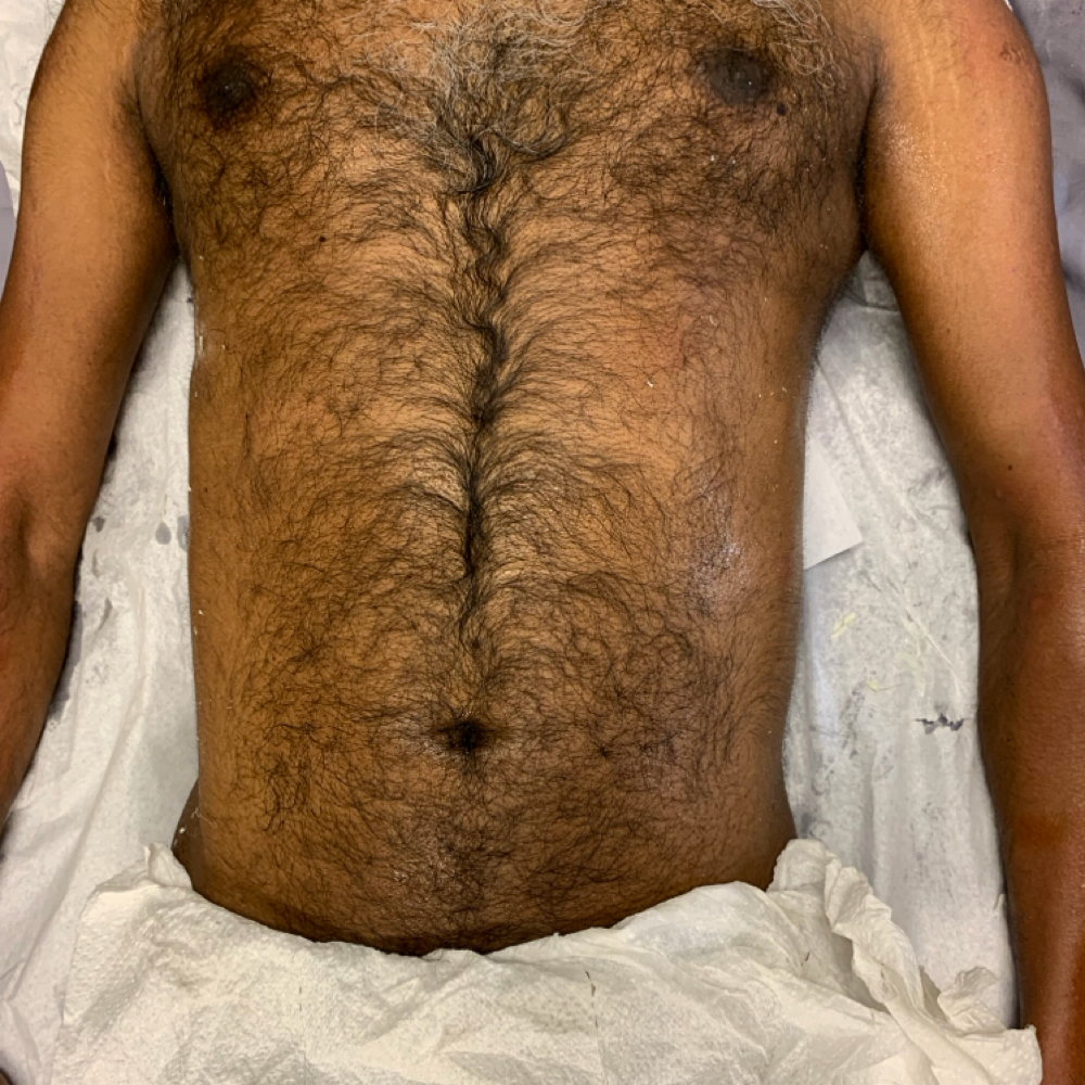 Chest Waxing at Poshii GOAT Esthetics in Carmel, IN