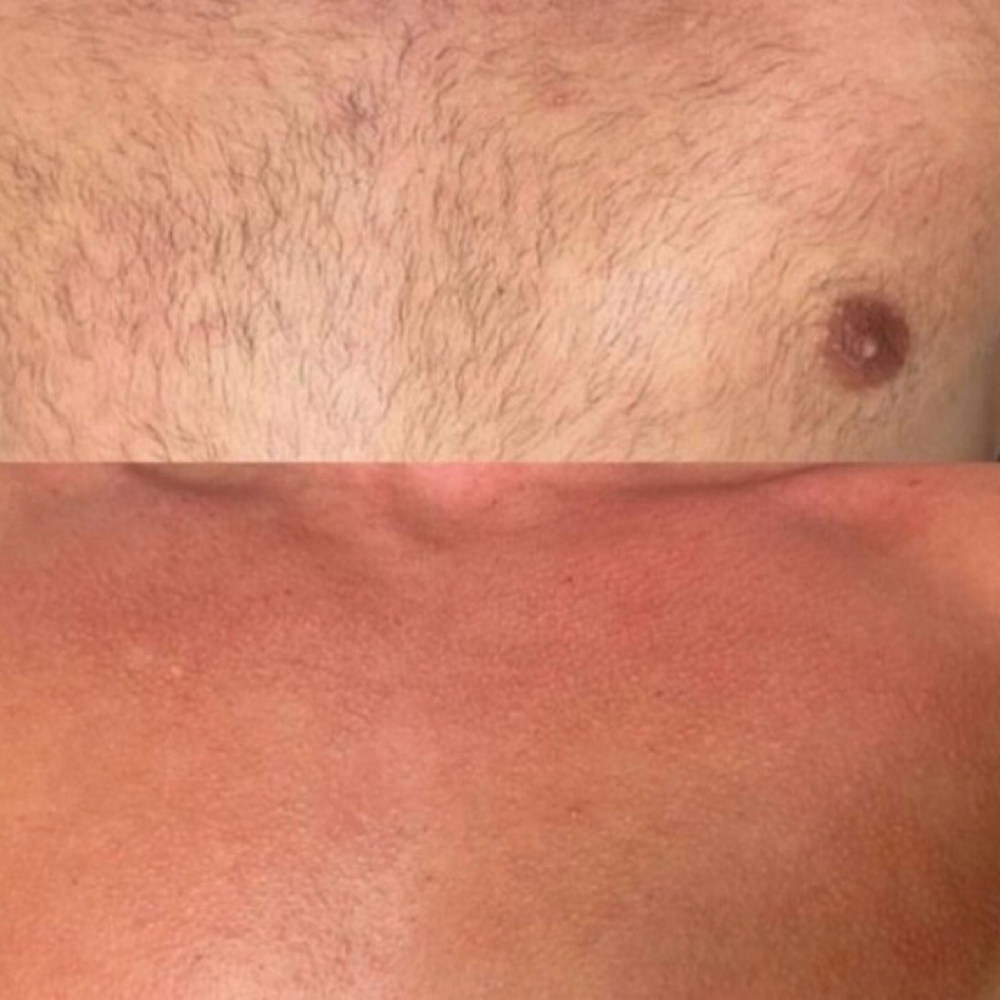 Chest at Nouvèl Beauty Collective in New London, CT