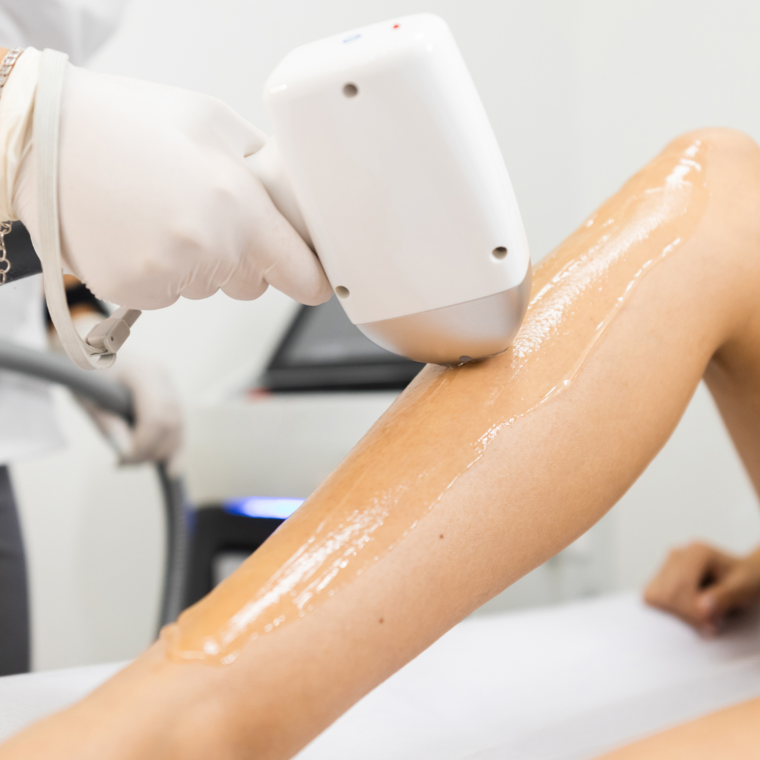 Laser Large Area at Aesthetica Organic Spa in Houston, TX