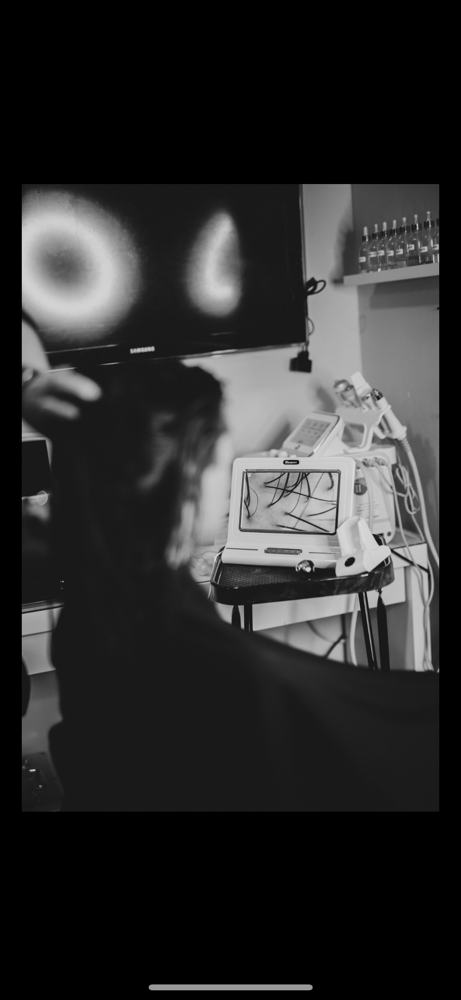 Scope And Scalp Analysis