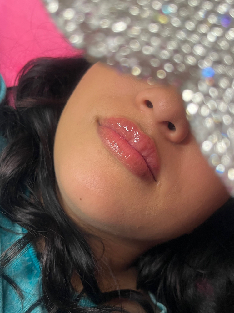 Hyluron Pen Lip Filler 1/2