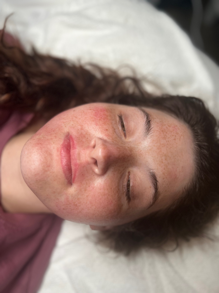 Dermaplaning Treatment at Sincerely Yours Esthetics LLC in West Lafayette, OH