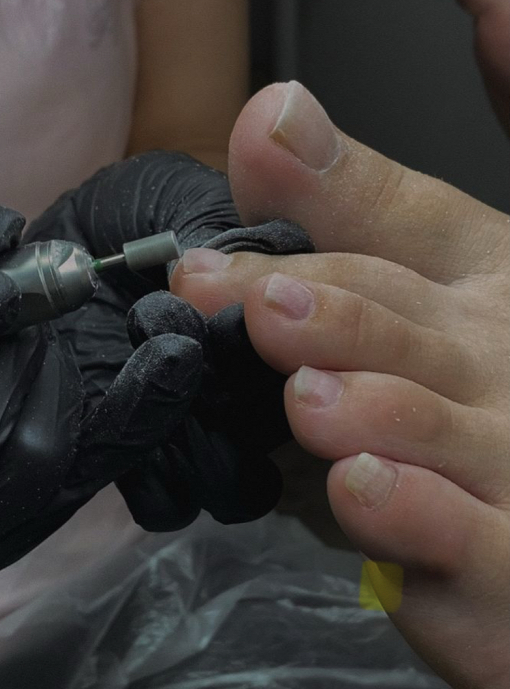 Acrylic Toes