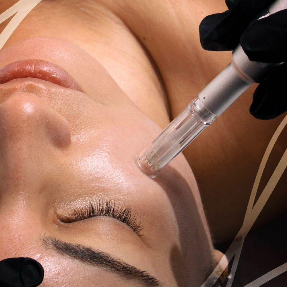 Collagen Boost Facial at Ur Glow Esthetician in Tarpon Springs, FL